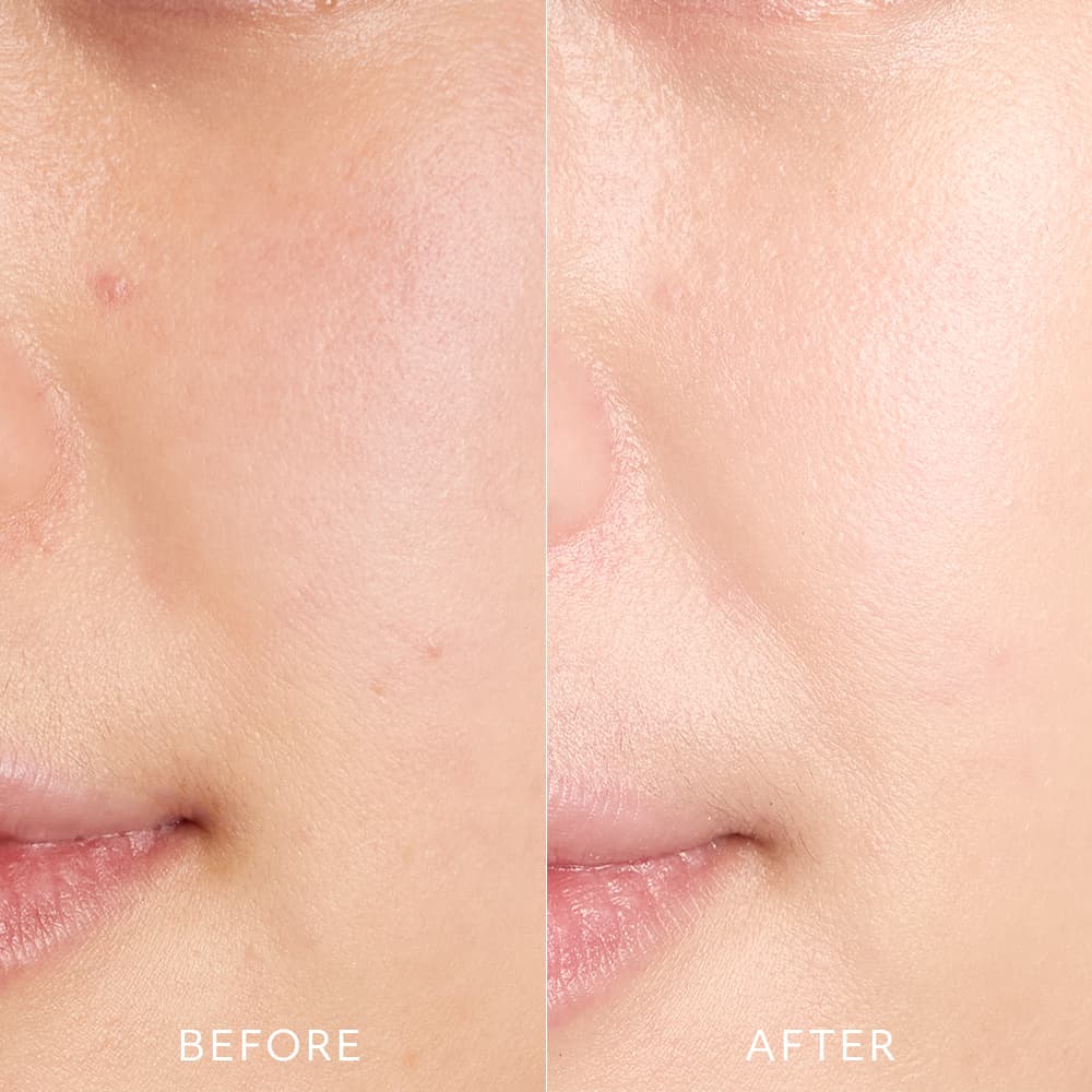 Naturaglacé UV Protection Base S - Image 2