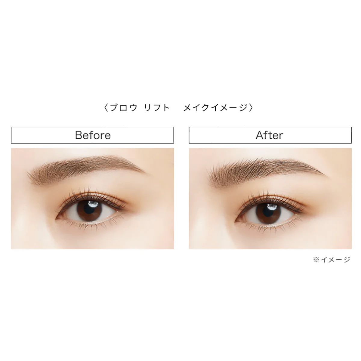 Visee Brow Lift - Image 3